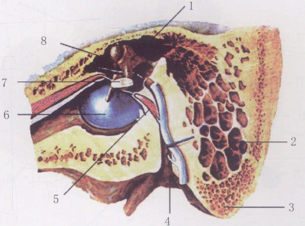 左中耳鼓室内异位颈内动脉一例 - 中华耳鼻咽喉头颈外科杂志